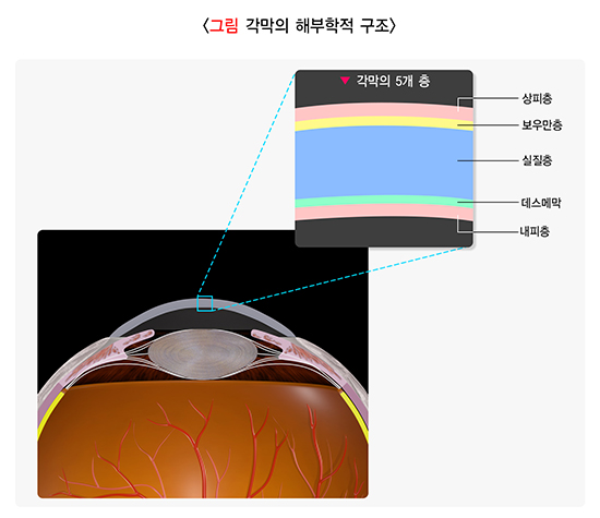 안구건조증 예방을 위한 눈물막 안정성 검사 및 수술 후 관리 팁
