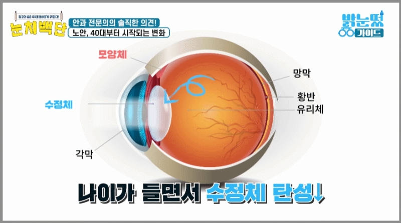노안과 백내장 비교 차트