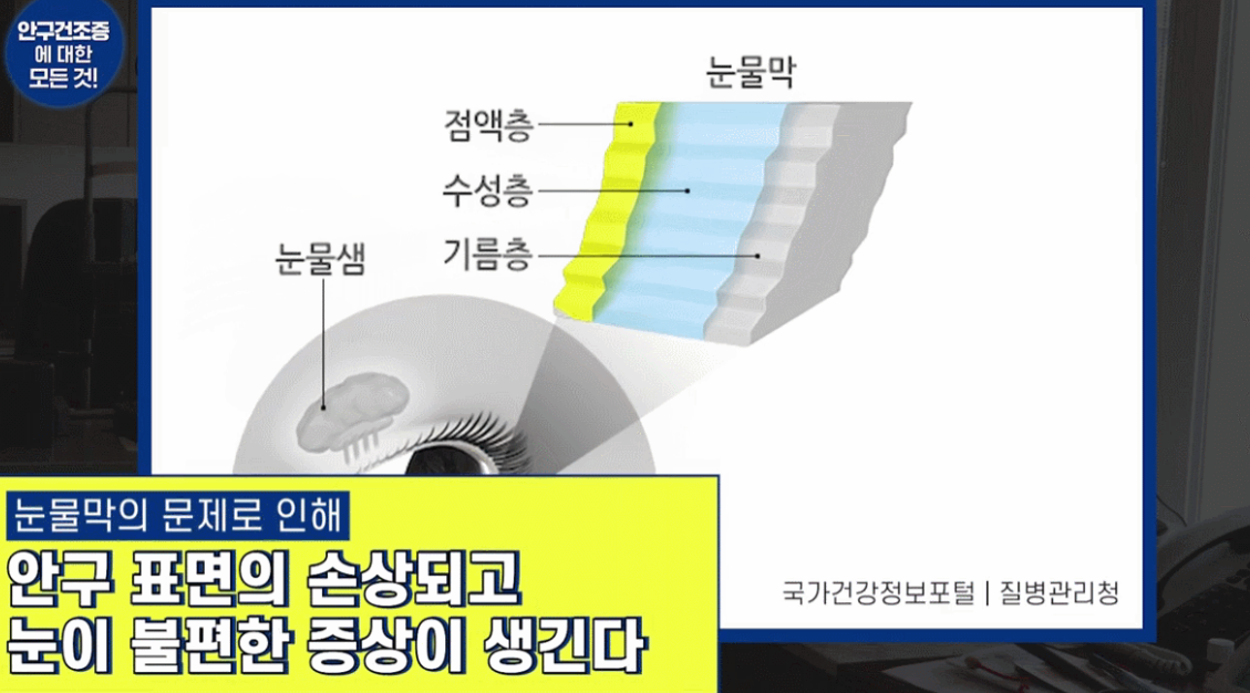 눈꺼풀 내부에 위치한 마이봄샘의 구조와 눈물 층(기름층, 물층, 점액층)의 원리 설명도