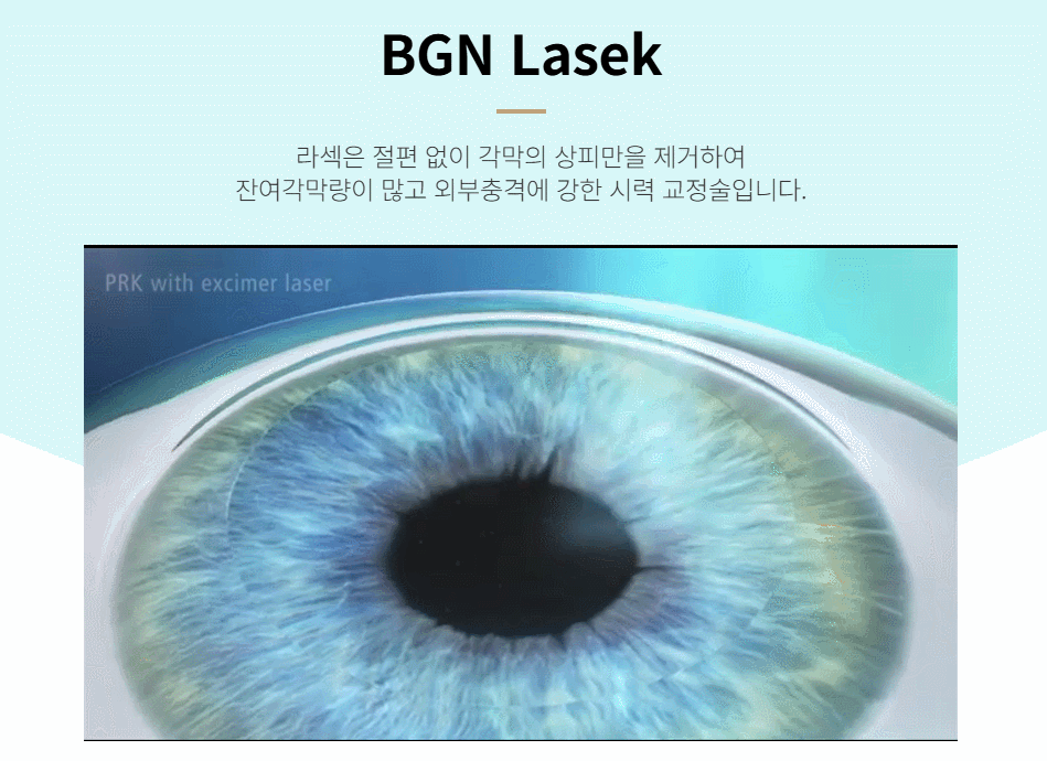 라섹 수술 과정에서 각막 상피가 제거되고 레이저가 조사되는 원리를 보여주는 의학 일러스트