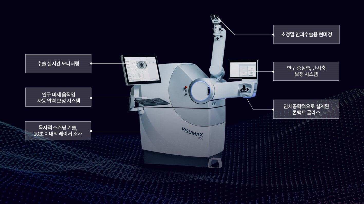 BGN밝은눈안과 잠실점에 도입된 최신 스마일 프로 장비 비쥬맥스 800 수술 모습