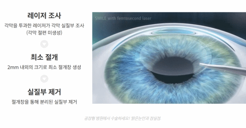 AI 기반의 정밀 검사 데이터 분석 시스템