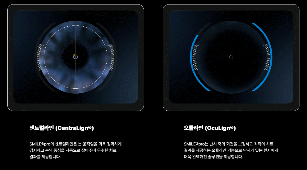 라식, 라섹, 스마일라식을 거쳐 스마일프로로 발전한 시력교정술의 단계별 진화 과정