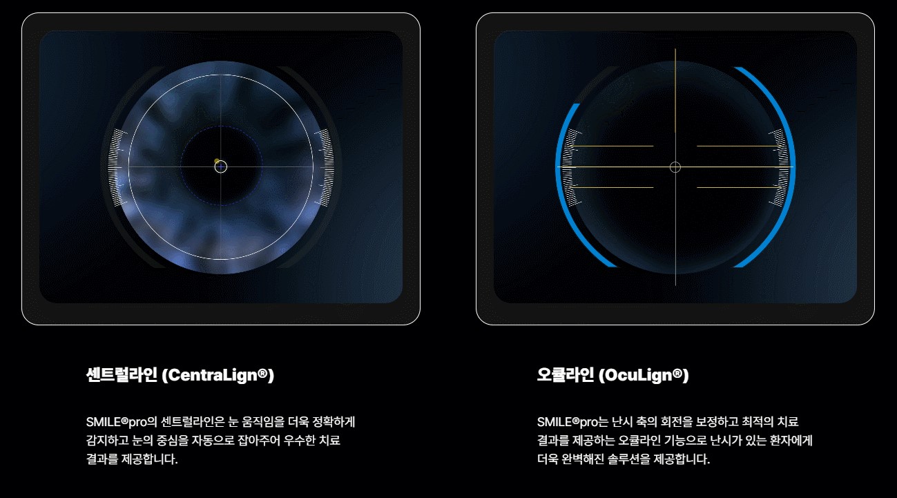센트럴라인과 오큘라인 기술이 적용된 시축 및 회전 보정 안내