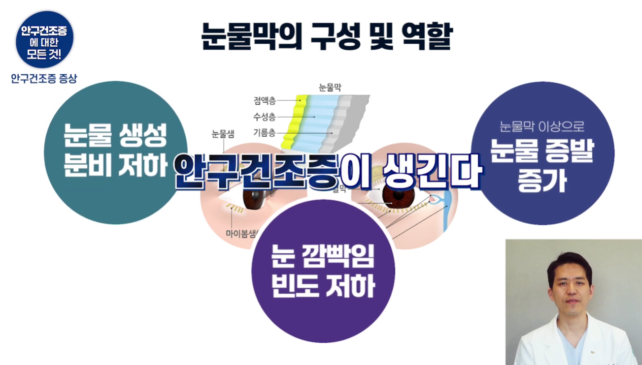 BGN밝은눈안과 잠실본점에서 통증 없이 10초 내외로 진행되는 정밀 플러그 시술 장면
