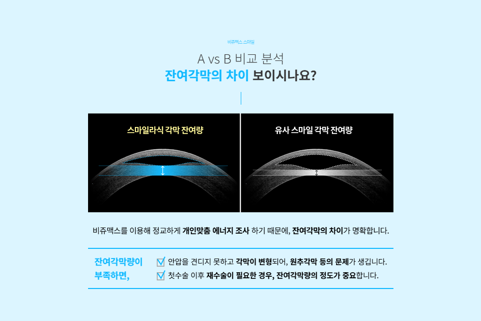 모니터에 출력된 선명한 망막 및 시신경 펀더스 촬영 결과 이미지