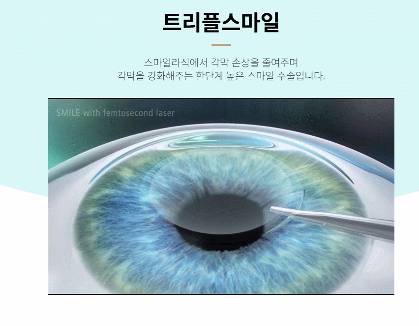 각막 절편 없이 최소 절개로 진행되어 안구건조증을 예방하는 스마일라식 수술 원리